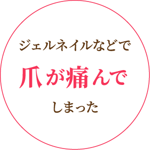 ジェルネイルなどで爪が痛んでしまった